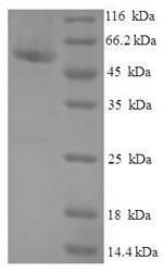(Tris-Glycine gel) Discontinuous SDS-PAGE (reduced) with 5% enrichment gel and 15% separation gel. (Tris-Glycine gel) Discontinuous SDS-PAGE (reduced) with 5% enrichment gel and 15% separation gel.