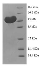 (Tris-Glycine gel) Discontinuous SDS-PAGE (reduced) with 5% enrichment gel and 15% separation gel. (Tris-Glycine gel) Discontinuous SDS-PAGE (reduced) with 5% enrichment gel and 15% separation gel.