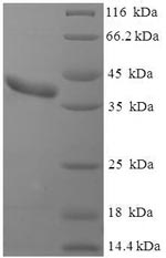 (Tris-Glycine gel) Discontinuous SDS-PAGE (reduced) with 5% enrichment gel and 15% separation gel.