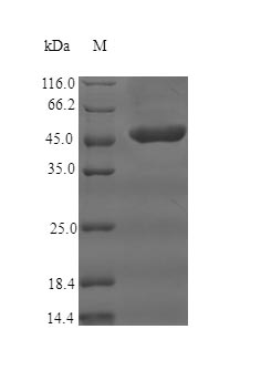 (Tris-Glycine gel) Discontinuous SDS-PAGE (reduced) with 5% enrichment gel and 15% separation gel. (Tris-Glycine gel) Discontinuous SDS-PAGE (reduced) with 5% enrichment gel and 15% separation gel.