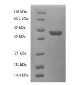 (Tris-Glycine gel) Discontinuous SDS-PAGE (reduced) with 5% enrichment gel and 15% separation gel. (Tris-Glycine gel) Discontinuous SDS-PAGE (reduced) with 5% enrichment gel and 15% separation gel.
