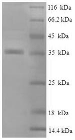 SDS-PAGE- Recombinant protein Human CRYAB