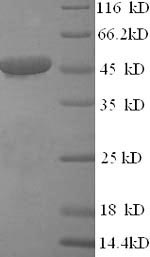 (Tris-Glycine gel) Discontinuous SDS-PAGE (reduced) with 5% enrichment gel and 15% separation gel.