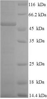 (Tris-Glycine gel) Discontinuous SDS-PAGE (reduced) with 5% enrichment gel and 15% separation gel. (Tris-Glycine gel) Discontinuous SDS-PAGE (reduced) with 5% enrichment gel and 15% separation gel.