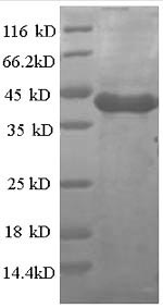 SDS-PAGE- Recombinant protein Human CSNK1A1