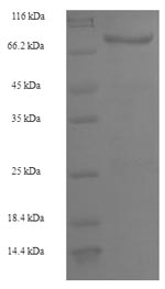 (Tris-Glycine gel) Discontinuous SDS-PAGE (reduced) with 5% enrichment gel and 15% separation gel. (Tris-Glycine gel) Discontinuous SDS-PAGE (reduced) with 5% enrichment gel and 15% separation gel.