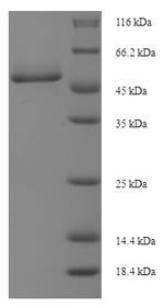 (Tris-Glycine gel) Discontinuous SDS-PAGE (reduced) with 5% enrichment gel and 15% separation gel.