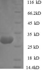 (Tris-Glycine gel) Discontinuous SDS-PAGE (reduced) with 5% enrichment gel and 15% separation gel.