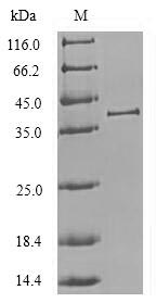 (Tris-Glycine gel) Discontinuous SDS-PAGE (reduced) with 5% enrichment gel and 15% separation gel.
