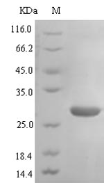 (Tris-Glycine gel) Discontinuous SDS-PAGE (reduced) with 5% enrichment gel and 15% separation gel. (Tris-Glycine gel) Discontinuous SDS-PAGE (reduced) with 5% enrichment gel and 15% separation gel.