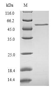 (Tris-Glycine gel) Discontinuous SDS-PAGE (reduced) with 5% enrichment gel and 15% separation gel. (Tris-Glycine gel) Discontinuous SDS-PAGE (reduced) with 5% enrichment gel and 15% separation gel.