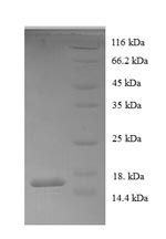 (Tris-Glycine gel) Discontinuous SDS-PAGE (reduced) with 5% enrichment gel and 15% separation gel. (Tris-Glycine gel) Discontinuous SDS-PAGE (reduced) with 5% enrichment gel and 15% separation gel.