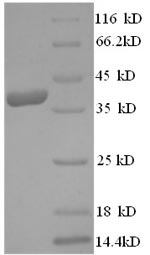 (Tris-Glycine gel) Discontinuous SDS-PAGE (reduced) with 5% enrichment gel and 15% separation gel.