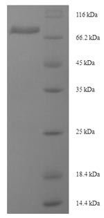 (Tris-Glycine gel) Discontinuous SDS-PAGE (reduced) with 5% enrichment gel and 15% separation gel. (Tris-Glycine gel) Discontinuous SDS-PAGE (reduced) with 5% enrichment gel and 15% separation gel.