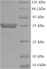 (Tris-Glycine gel) Discontinuous SDS-PAGE (reduced) with 5% enrichment gel and 15% separation gel. (Tris-Glycine gel) Discontinuous SDS-PAGE (reduced) with 5% enrichment gel and 15% separation gel.