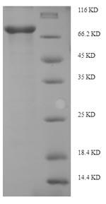 SDS-PAGE- Recombinant protein Human EIF2AK2