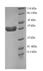 (Tris-Glycine gel) Discontinuous SDS-PAGE (reduced) with 5% enrichment gel and 15% separation gel. (Tris-Glycine gel) Discontinuous SDS-PAGE (reduced) with 5% enrichment gel and 15% separation gel.