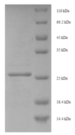(Tris-Glycine gel) Discontinuous SDS-PAGE (reduced) with 5% enrichment gel and 15% separation gel. (Tris-Glycine gel) Discontinuous SDS-PAGE (reduced) with 5% enrichment gel and 15% separation gel.