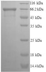 (Tris-Glycine gel) Discontinuous SDS-PAGE (reduced) with 5% enrichment gel and 15% separation gel. (Tris-Glycine gel) Discontinuous SDS-PAGE (reduced) with 5% enrichment gel and 15% separation gel.
