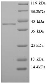 (Tris-Glycine gel) Discontinuous SDS-PAGE (reduced) with 5% enrichment gel and 15% separation gel. (Tris-Glycine gel) Discontinuous SDS-PAGE (reduced) with 5% enrichment gel and 15% separation gel.