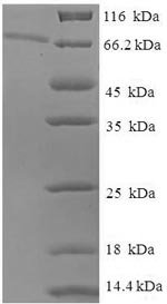 SDS-PAGE- Recombinant protein Human EPHX1