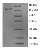 SDS-PAGE- Recombinant protein Human ERBB2