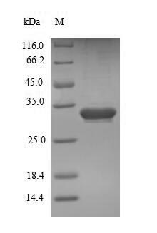 (Tris-Glycine gel) Discontinuous SDS-PAGE (reduced) with 5% enrichment gel and 15% separation gel. (Tris-Glycine gel) Discontinuous SDS-PAGE (reduced) with 5% enrichment gel and 15% separation gel.