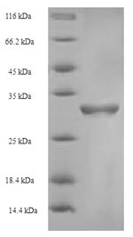 (Tris-Glycine gel) Discontinuous SDS-PAGE (reduced) with 5% enrichment gel and 15% separation gel. (Tris-Glycine gel) Discontinuous SDS-PAGE (reduced) with 5% enrichment gel and 15% separation gel.