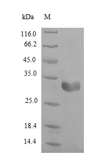 (Tris-Glycine gel) Discontinuous SDS-PAGE (reduced) with 5% enrichment gel and 15% separation gel. (Tris-Glycine gel) Discontinuous SDS-PAGE (reduced) with 5% enrichment gel and 15% separation gel.