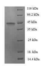 (Tris-Glycine gel) Discontinuous SDS-PAGE (reduced) with 5% enrichment gel and 15% separation gel. (Tris-Glycine gel) Discontinuous SDS-PAGE (reduced) with 5% enrichment gel and 15% separation gel.