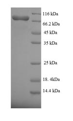 SDS-PAGE- Recombinant protein Human FANCC