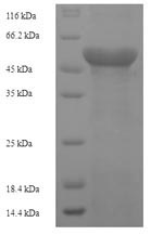 (Tris-Glycine gel) Discontinuous SDS-PAGE (reduced) with 5% enrichment gel and 15% separation gel. (Tris-Glycine gel) Discontinuous SDS-PAGE (reduced) with 5% enrichment gel and 15% separation gel.