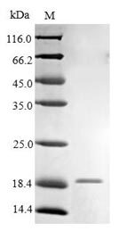 (Tris-Glycine gel) Discontinuous SDS-PAGE (reduced) with 5% enrichment gel and 15% separation gel. (Tris-Glycine gel) Discontinuous SDS-PAGE (reduced) with 5% enrichment gel and 15% separation gel.