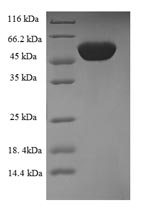 (Tris-Glycine gel) Discontinuous SDS-PAGE (reduced) with 5% enrichment gel and 15% separation gel. (Tris-Glycine gel) Discontinuous SDS-PAGE (reduced) with 5% enrichment gel and 15% separation gel.
