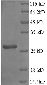 (Tris-Glycine gel) Discontinuous SDS-PAGE (reduced) with 5% enrichment gel and 15% separation gel. (Tris-Glycine gel) Discontinuous SDS-PAGE (reduced) with 5% enrichment gel and 15% separation gel.