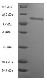(Tris-Glycine gel) Discontinuous SDS-PAGE (reduced) with 5% enrichment gel and 15% separation gel. (Tris-Glycine gel) Discontinuous SDS-PAGE (reduced) with 5% enrichment gel and 15% separation gel.