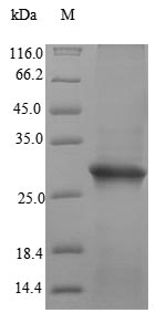 (Tris-Glycine gel) Discontinuous SDS-PAGE (reduced) with 5% enrichment gel and 15% separation gel. (Tris-Glycine gel) Discontinuous SDS-PAGE (reduced) with 5% enrichment gel and 15% separation gel.