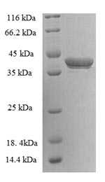 SDS-PAGE- Recombinant protein Human GAGE5