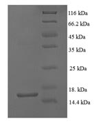 (Tris-Glycine gel) Discontinuous SDS-PAGE (reduced) with 5% enrichment gel and 15% separation gel. (Tris-Glycine gel) Discontinuous SDS-PAGE (reduced) with 5% enrichment gel and 15% separation gel.