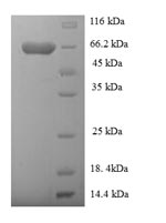 SDS-PAGE- Recombinant protein Human GDI2