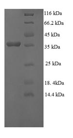 SDS-PAGE- Recombinant protein Human GGCT