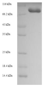SDS-PAGE- Recombinant protein Human GK2