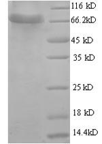 (Tris-Glycine gel) Discontinuous SDS-PAGE (reduced) with 5% enrichment gel and 15% separation gel. (Tris-Glycine gel) Discontinuous SDS-PAGE (reduced) with 5% enrichment gel and 15% separation gel.