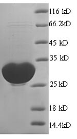 (Tris-Glycine gel) Discontinuous SDS-PAGE (reduced) with 5% enrichment gel and 15% separation gel. (Tris-Glycine gel) Discontinuous SDS-PAGE (reduced) with 5% enrichment gel and 15% separation gel.