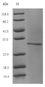 SDS-PAGE- Recombinant protein Human GLS