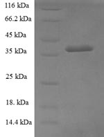 SDS-PAGE- Recombinant protein Human GNPDA1