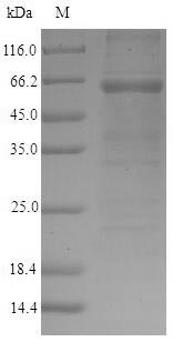 (Tris-Glycine gel) Discontinuous SDS-PAGE (reduced) with 5% enrichment gel and 15% separation gel. (Tris-Glycine gel) Discontinuous SDS-PAGE (reduced) with 5% enrichment gel and 15% separation gel.