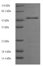 (Tris-Glycine gel) Discontinuous SDS-PAGE (reduced) with 5% enrichment gel and 15% separation gel. (Tris-Glycine gel) Discontinuous SDS-PAGE (reduced) with 5% enrichment gel and 15% separation gel.