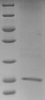 (Tris-Glycine gel) Discontinuous SDS-PAGE (reduced) with 5% enrichment gel and 15% separation gel. (Tris-Glycine gel) Discontinuous SDS-PAGE (reduced) with 5% enrichment gel and 15% separation gel.