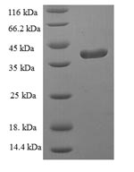 SDS-PAGE- Recombinant protein Human GPX1